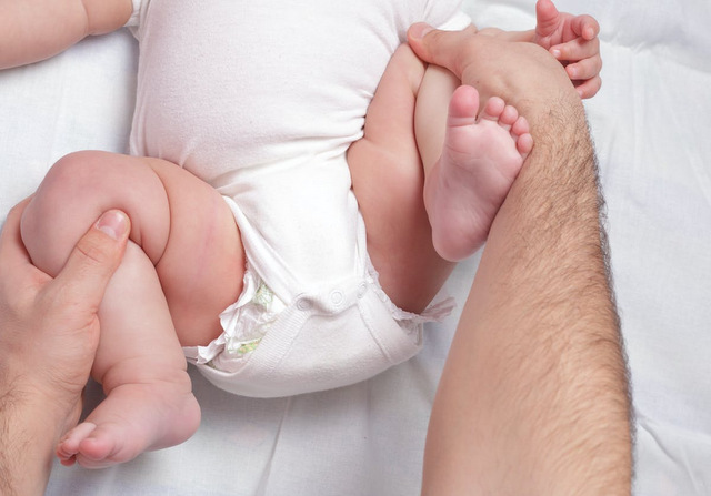 Trẻ sơ sinh chân ngắn phải làm sao & Cách cải thiện chân ngắn cho trẻ sơ sinh