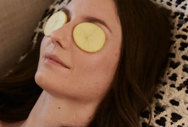 Khoai tây là cách trị thâm quầng mắt tại nhà khá hiệu quả. Các bạn có thể dùng khoai tây làm mặt nạ trị thâm quầng mắt